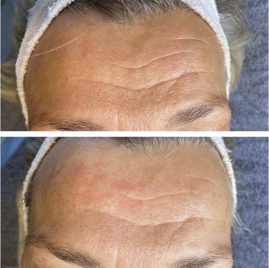 Instagram Ultraterapi